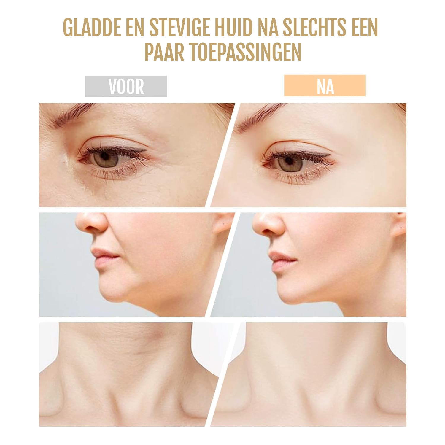 7-in-1 Facelift Apparaat voor Huidverjonging – Anti-Aging Gezichtsmassager en Rimpelverwijderaar voor Hals en Gezicht